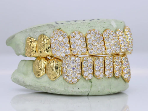 10 on 10 Jumbo Double Rose Cut Cap VVS Moissanite Diamond Grillz