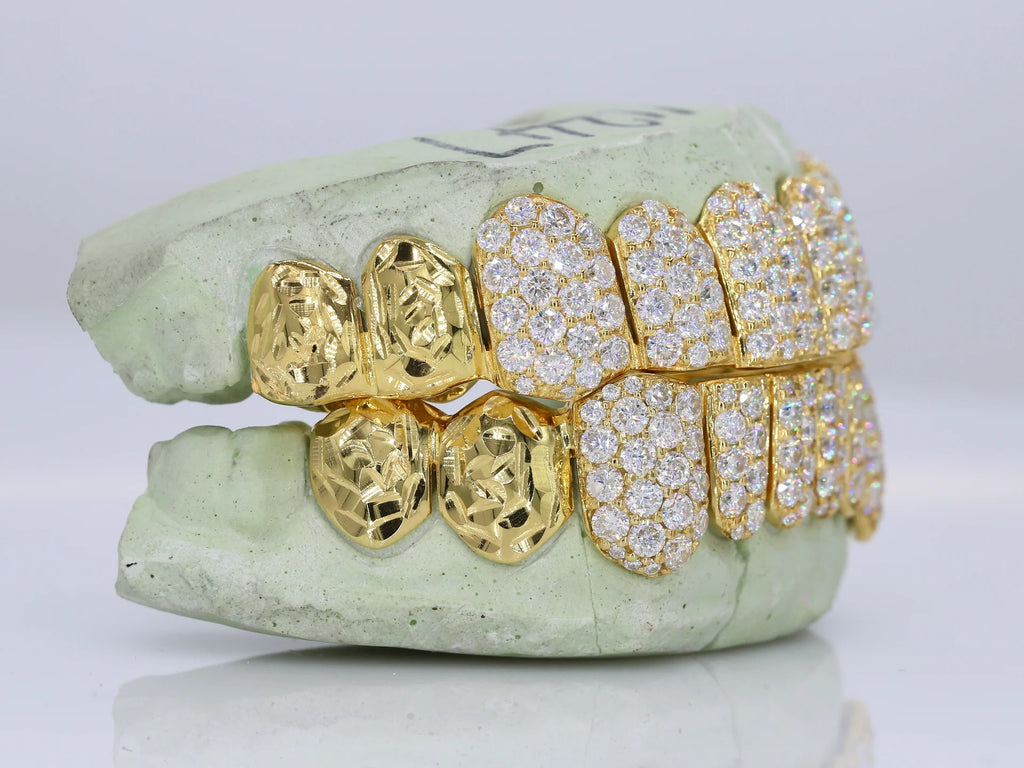 10 on 10 Jumbo Double Rose Cut Cap VVS Moissanite Diamond Grillz